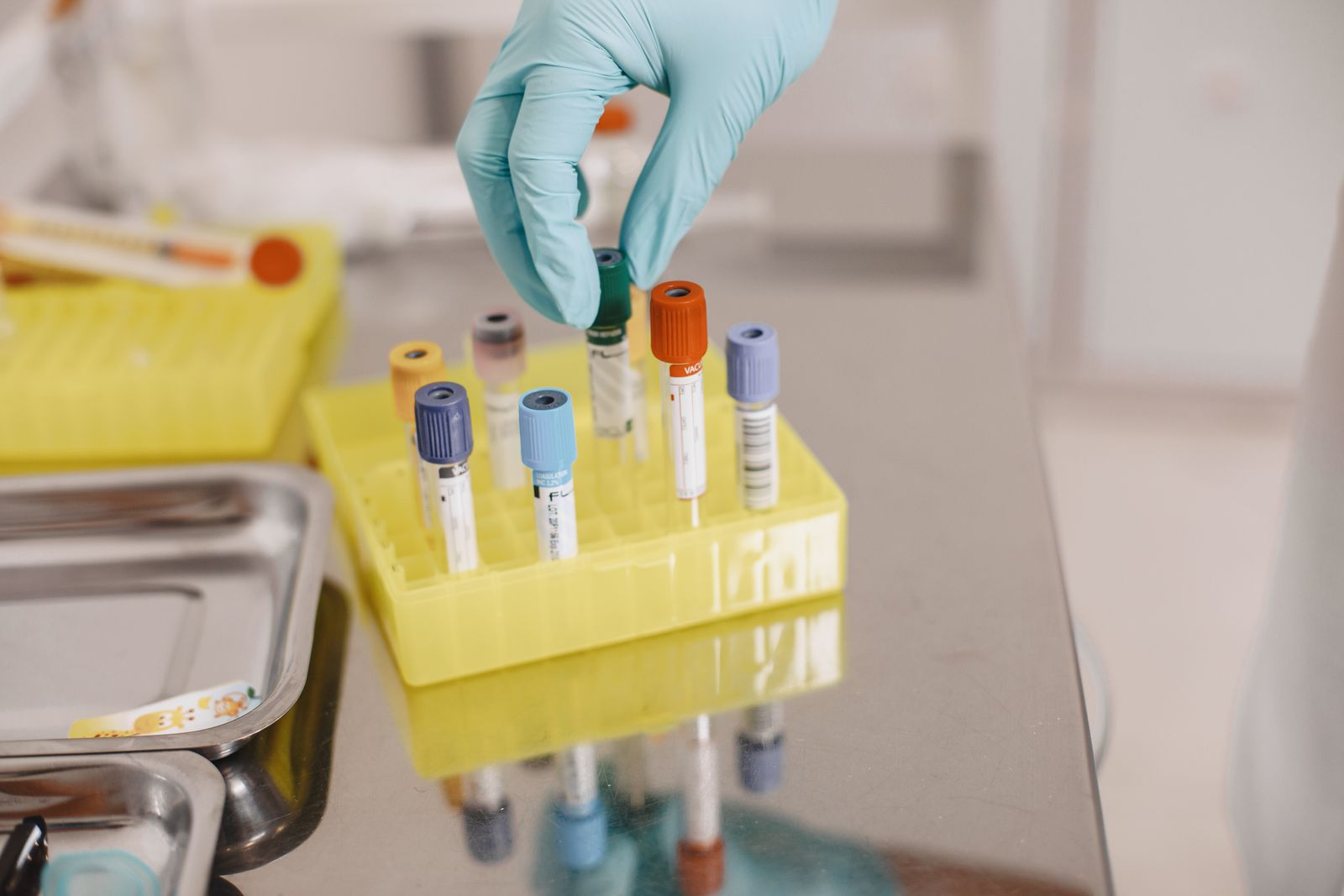 Rukavice u laboratoriji: osnovna pravila